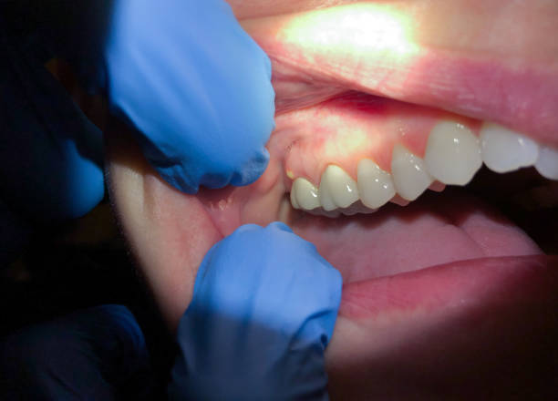Dentist for Dental Trauma in TN